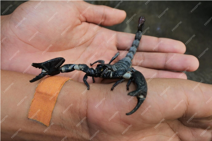 scorpion sting symptoms