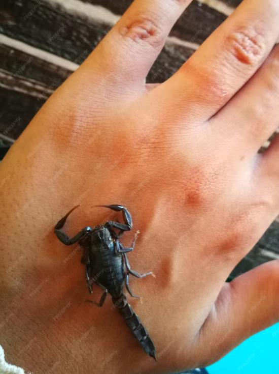 scorpion bite pictures